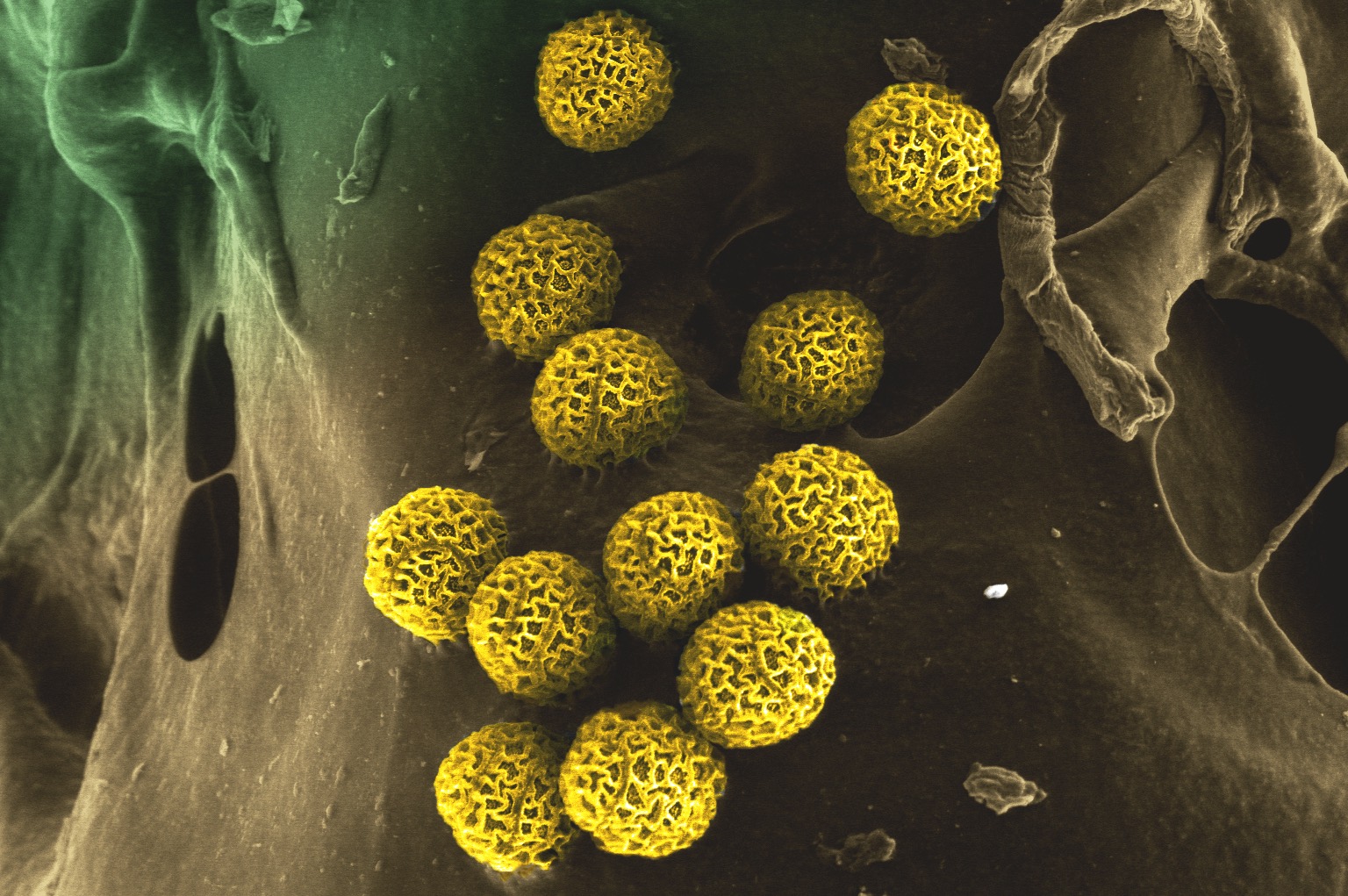 Пыльца растений является. Пыльца амброзии под микроскопом. Поллиноз пыльцевые зерна. Амброзию пыльца микроскоп. Микроспора пыльцевое зерно.